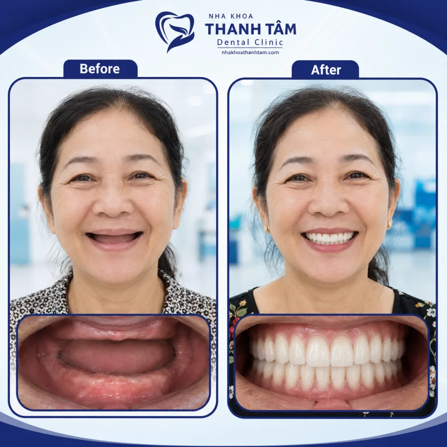 Ảnh minh hoạ trước & sau 2