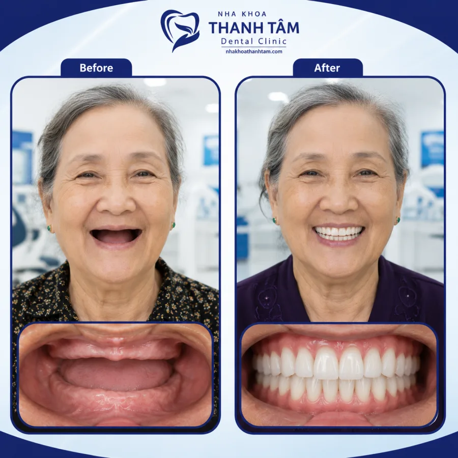 Ảnh minh hoạ trước & sau 3