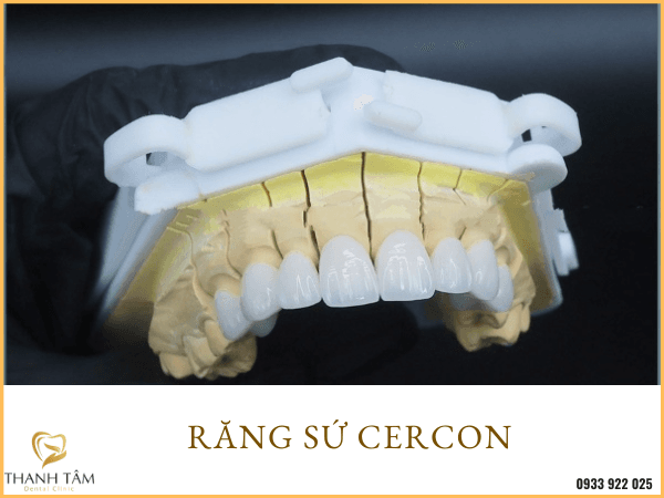 Răng Sứ Zirconia Và Cercon Loại Nào Tốt Hơn? Chọn Loại Nào