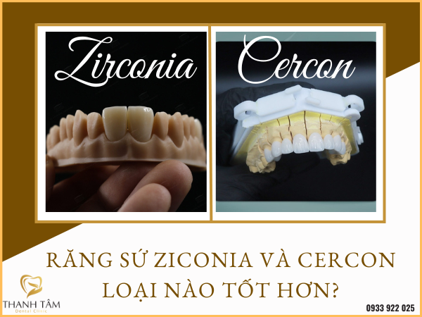 răng sứ zirconia và cercon