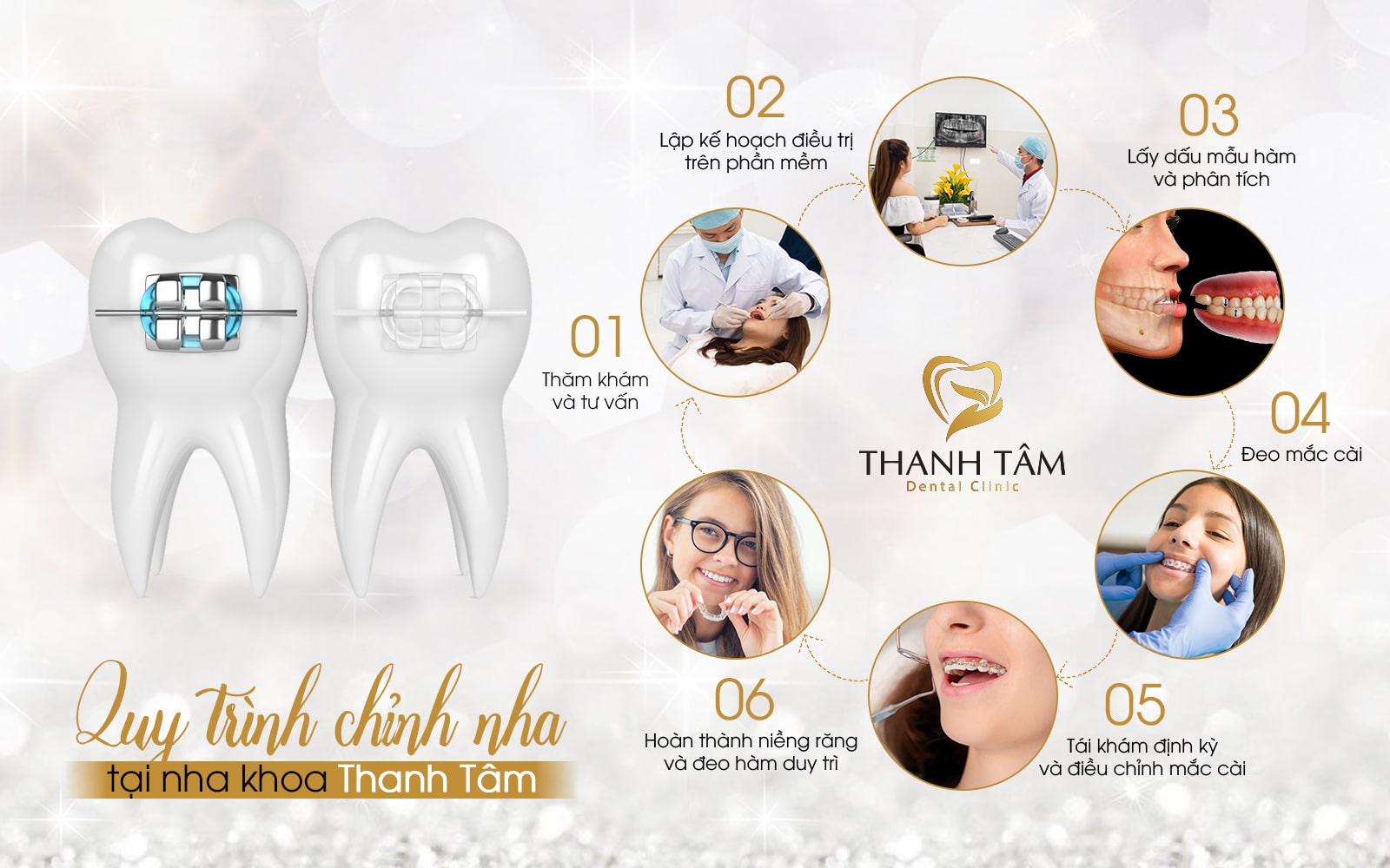 Chỉnh Nha Là Gì? 4 Lưu Ý Quan Trọng Khi Chỉnh Nha