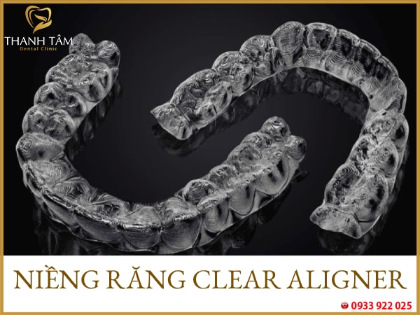 niềng răng trong suốt clear aligner
