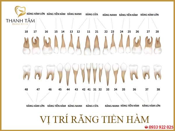 Răng tiền hàm