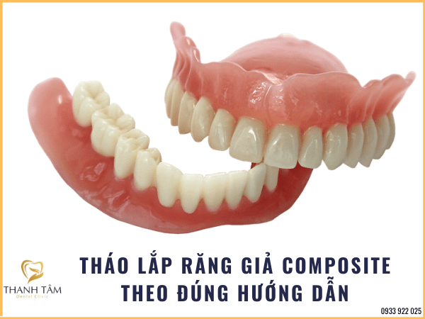 răng tháo lắp composite