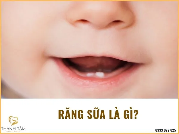 Thứ tự mọc răng sữa của bé