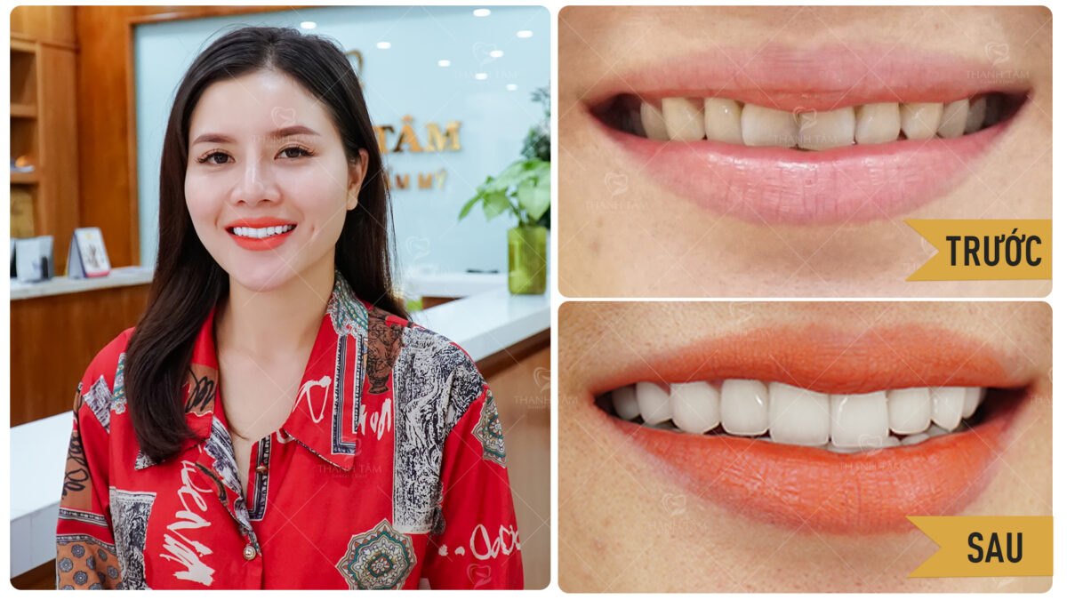 ĐINH-THỊ-THANH-TUYỀN