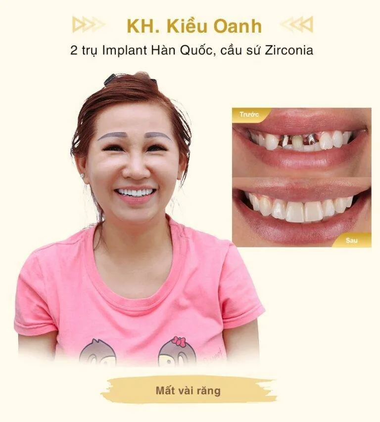 kieu-oanh