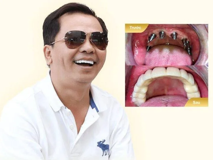 anh-ngoc-chinh