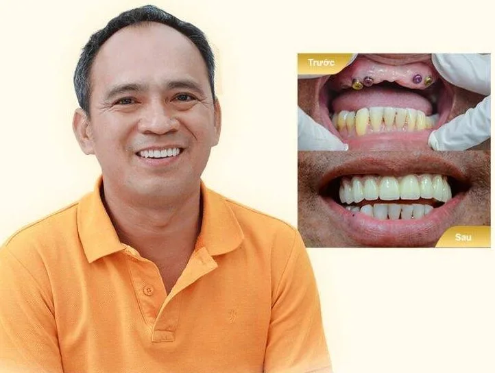 nguyen-the-vinh