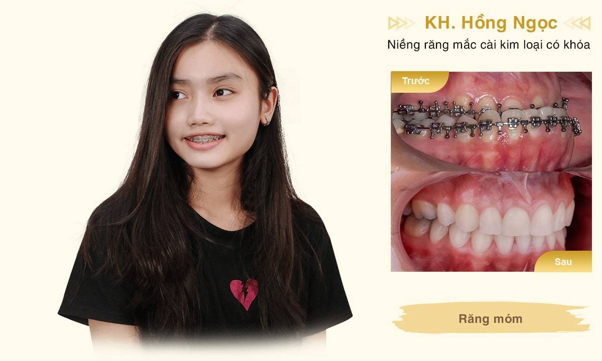 khách hàng hồng ngọc