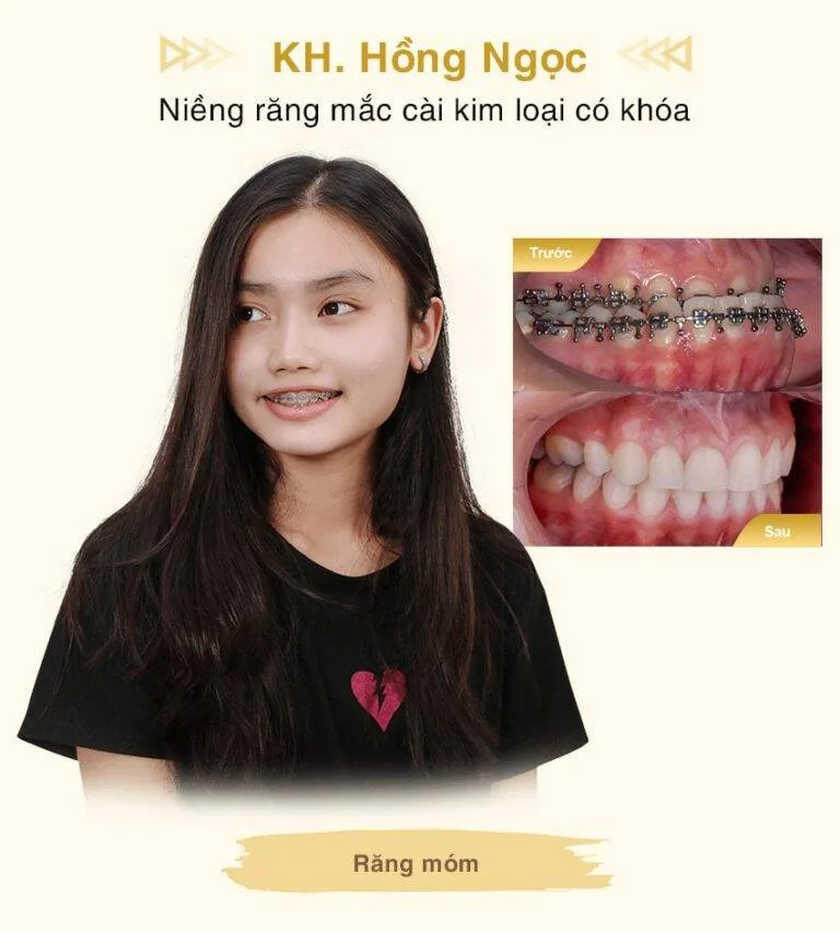 hong-ngoc