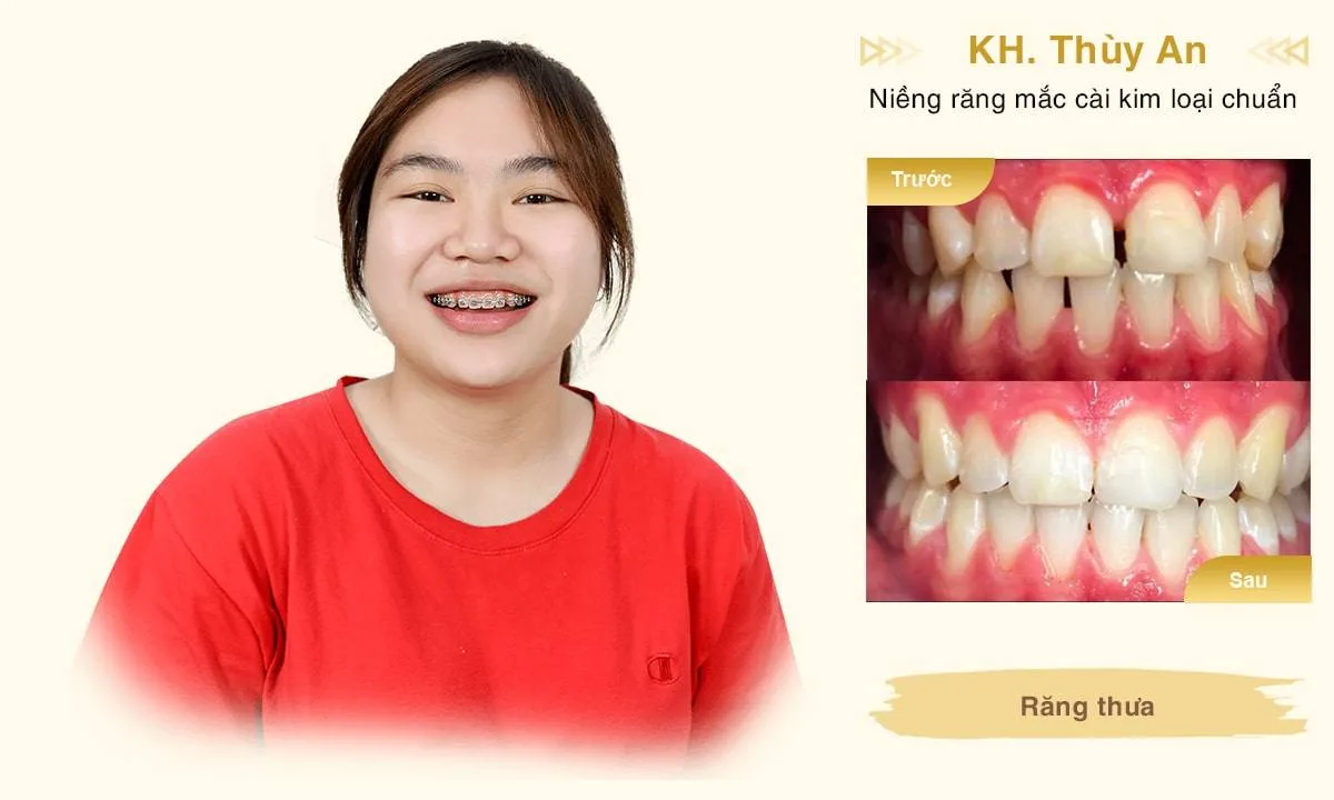 thuy-an